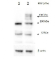 PRP40B | pre-mRNA-processing protein 40B